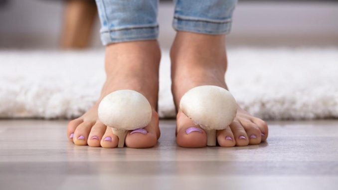 Comment traiter rapidement les mycoses des pieds
